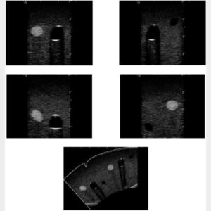 images échographiques structures internes fantômen d'entraînement nerf artère veine