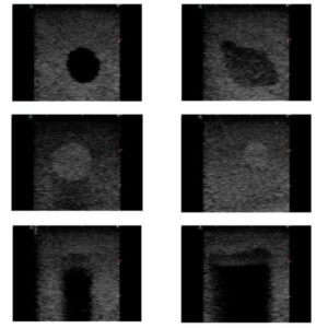 Images échographiques structures internes fantôme biopsie sein