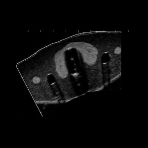 Structures internes fantôme d'entraînement biopsie thyroïde
