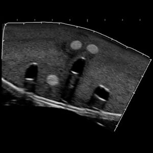 échographie structures internes fantôme d'entraînement nerfs et veines